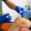 Preguntas frecuentes sobre el tratamiento de la artrosis de rodilla con PRP y ácido hialurónico en conjunto: ¿la combinación ideal para la artrosis de rodilla?