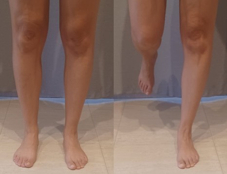 Ejercicio de equilibrio a una sola pierna drjordijimenez